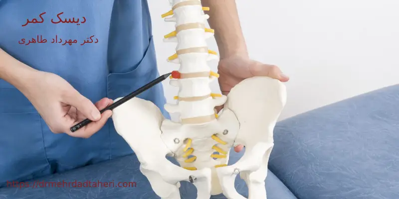 تشخیص دیسک کمر 