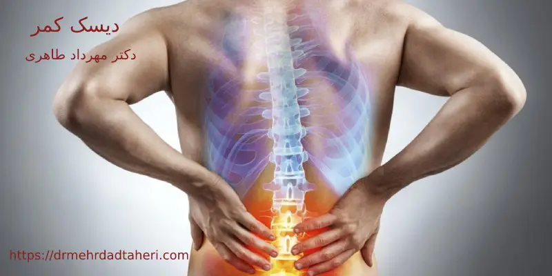 دیسک کمر