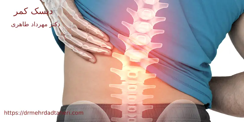 دیسک کمر چیست؟