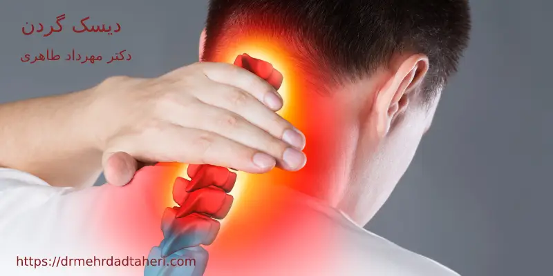 علائم دیسک گردن