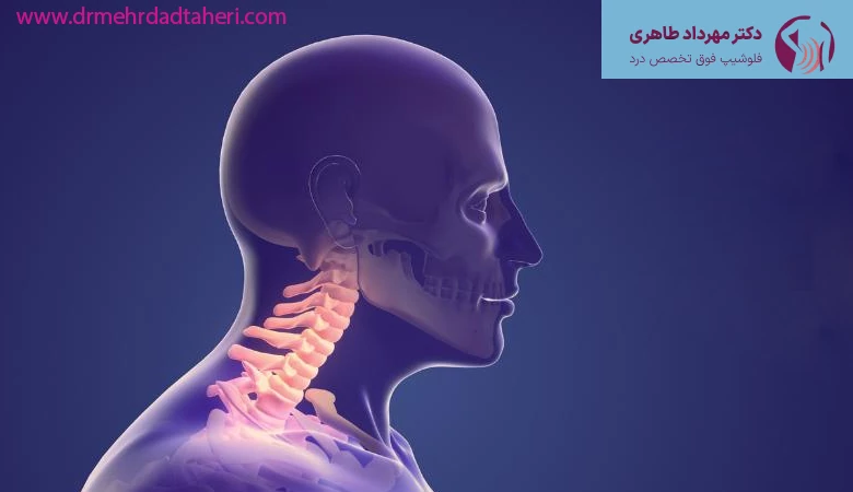 آیا برای درمان دیسک گردن درمان قطعی وجود دارد؟