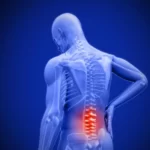 بهترین داروی دیسک کمر