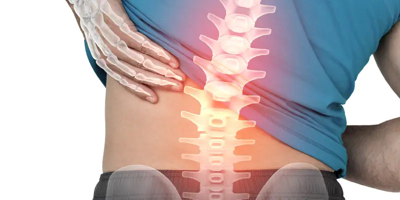 دهیدراته شدن دیسک کمر