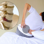 نحوه استراحت برای درمان دیسک کمر