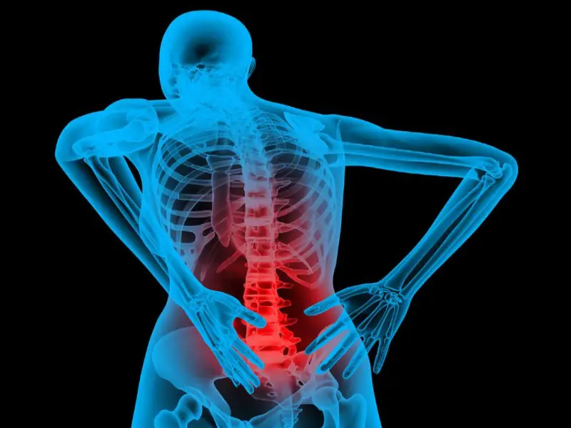 درمان درد سیاتیک با لیزر برای چه افرادی مناسب است؟