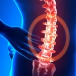 عمل دیسک کمر با لیزر + مزیت_ها و عوارض