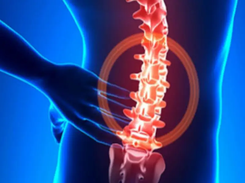 عمل دیسک کمر با لیزر + مزیت_ها و عوارض