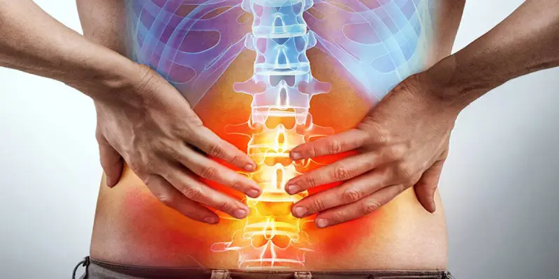 عوارض عمل سیاتیک با لیزر