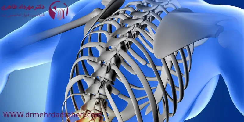 فیزیوتراپی از مراقبت_های بعد از عمل لیزری دیسک کمر