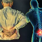 مراقبت_های بعد از عمل لیزری دیسک کمر