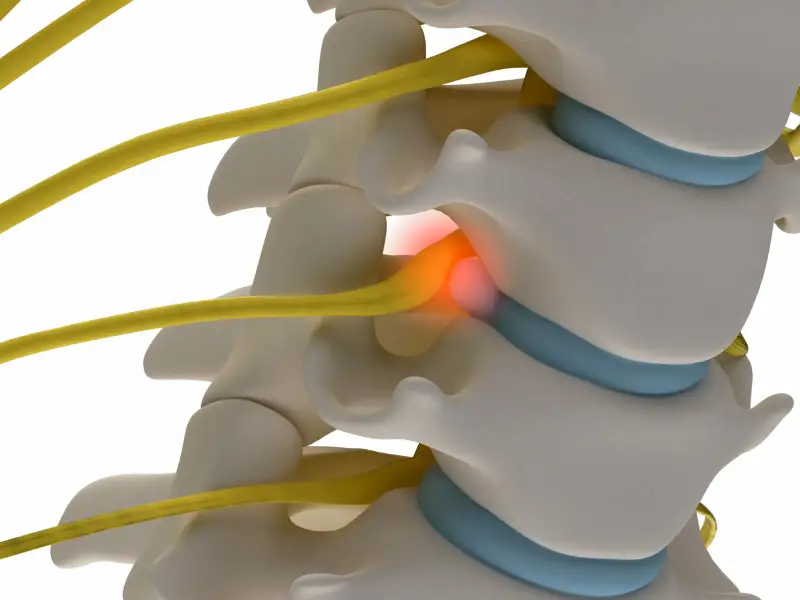 بهترین جراح دیسک کمر با لیزر در تهران