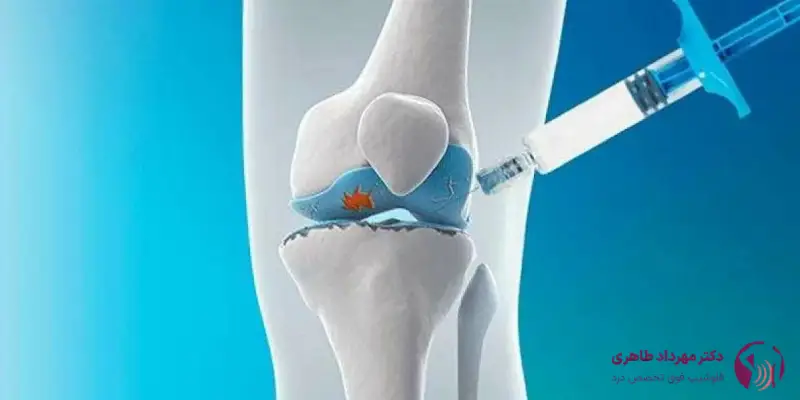 درمان درد زانو با سلول_های بنیادی