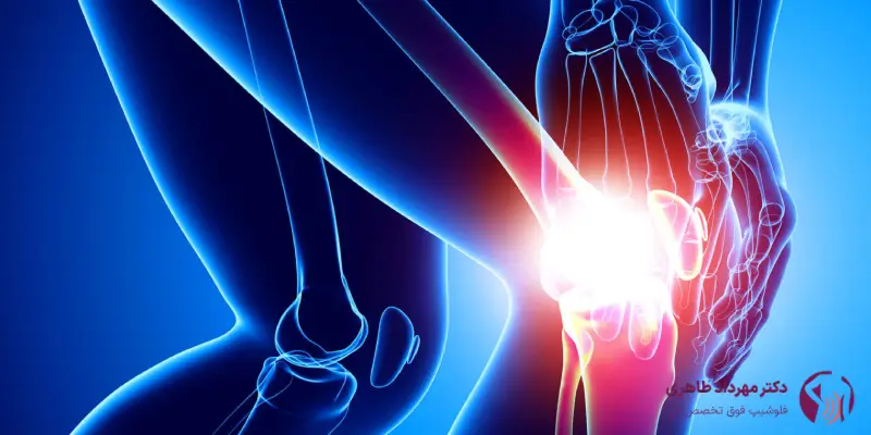 مزیت_های درمان درد زانو با سلول_های بنیادی
