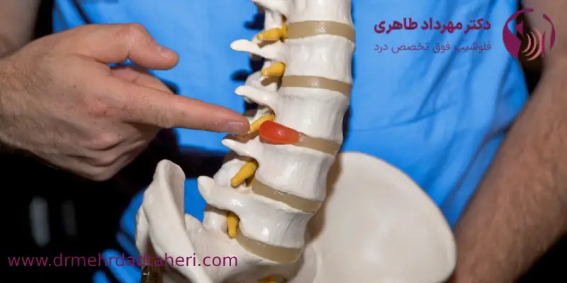 هزینه جراحی دیسک کمر با لیزر