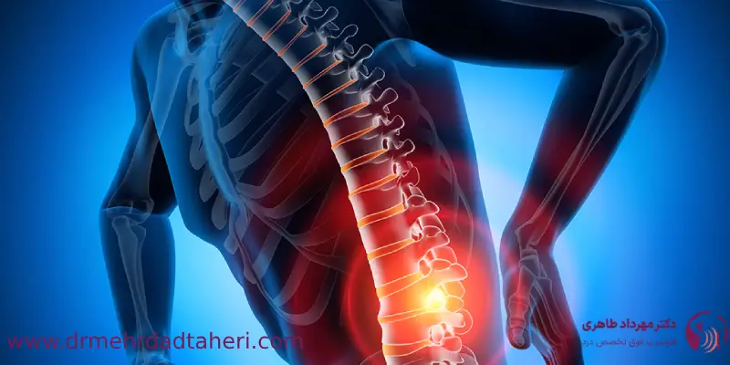 ورزش_های بعد از عمل دیسک با لیزر