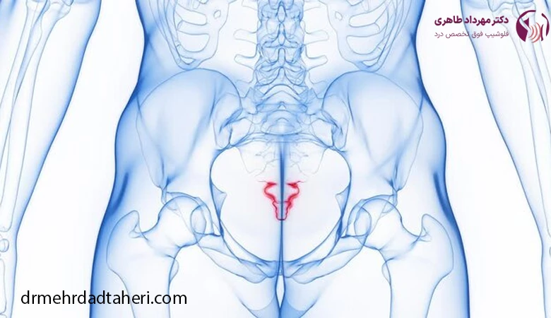 درد دنبالچه چیست؟