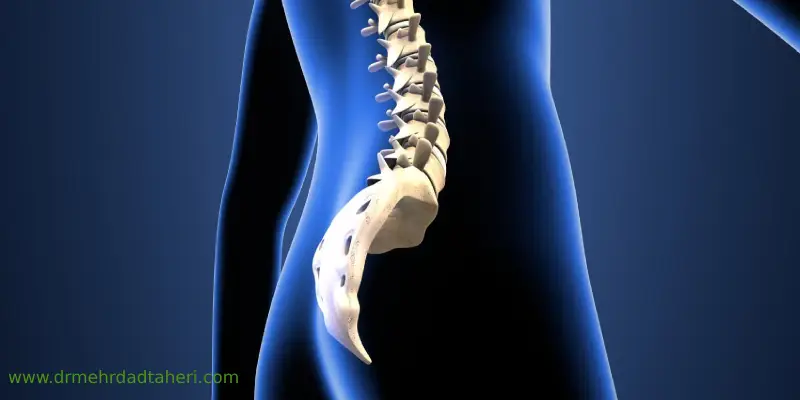 درمان خانگی درد دنبالچه 