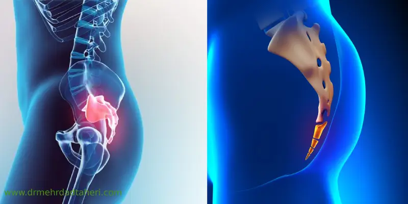 درمان خانگی درد دنبالچه 