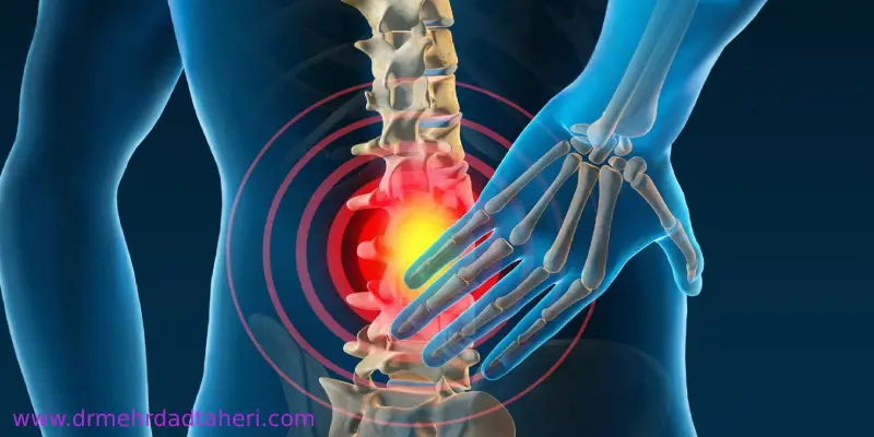 درمان درد دنبالچه با استفاده از بلوک عصبی