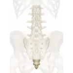 درمان درد دنبالچه با استفاده بلوک عصبی