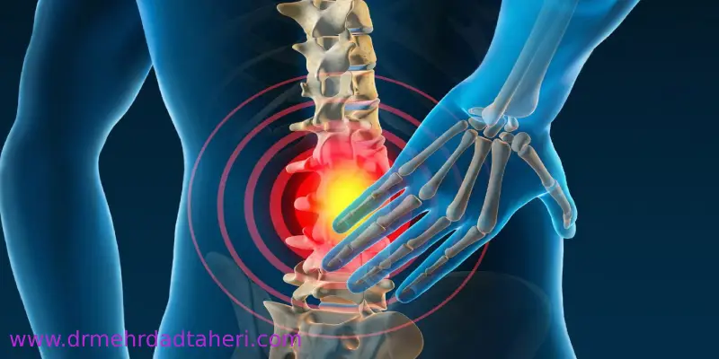 درمان درد دنبالچه با بلوک عصبی
