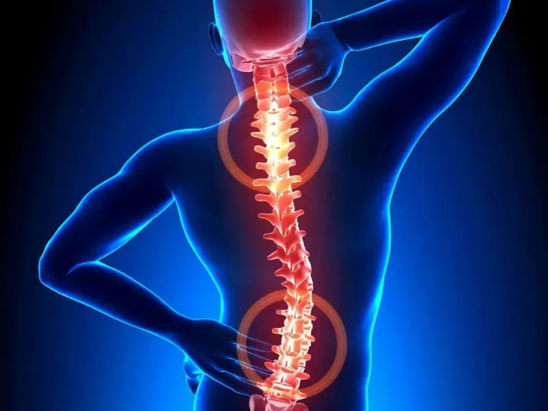 درمان دیسک کمر با استفاده از سلول بنیادی