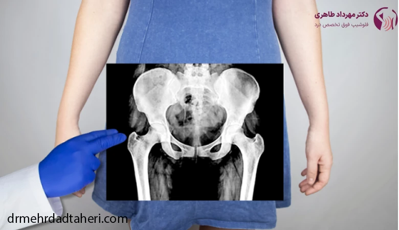 دلایل درد دنبالچه چیست؟