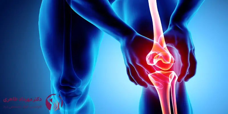 آسیب_های رباط و درد زانو