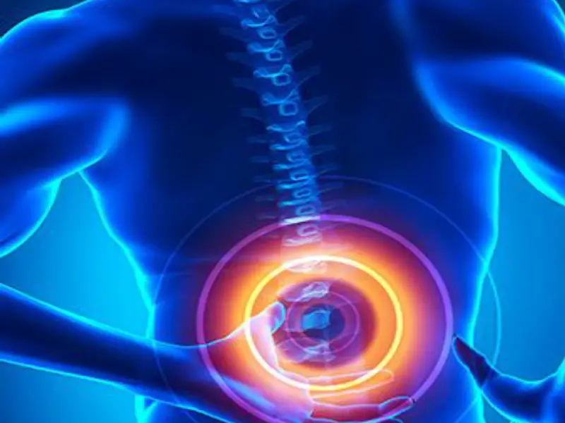 اوزون_تراپی دیسک کمر چیست و چه کاربردی دارد؟