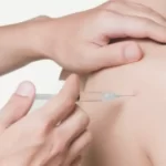 اوزون_تراپی یا اوزون_درمانی