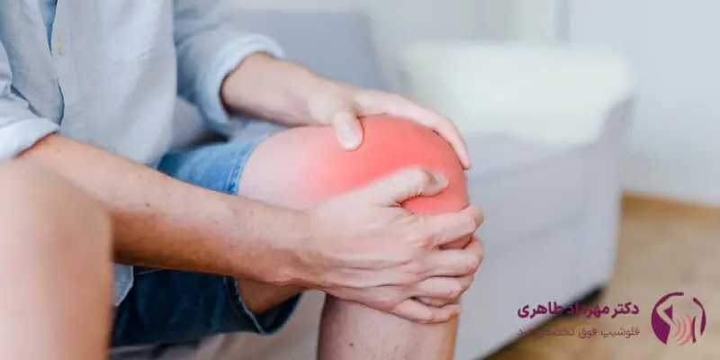 تاندونیت کشکک و درد زانو