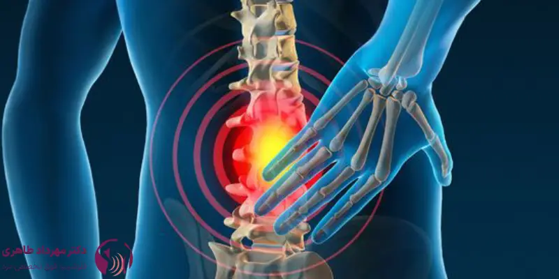 مراقبت_های بعد از اوزون_تراپی دیسک به چه صورت است؟