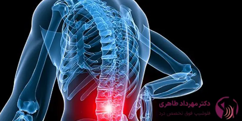 مکانیسم عمل اوزون تراپی دیسک کمر