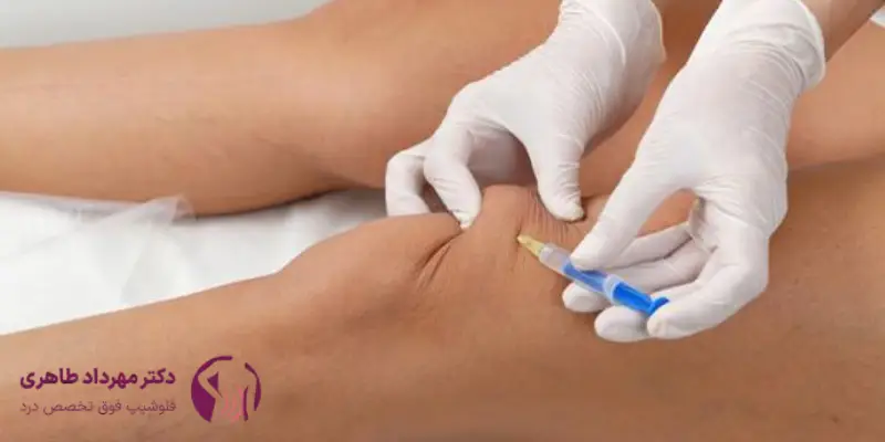 آیا اوزونتراپی برای سیاتیک موثر است؟