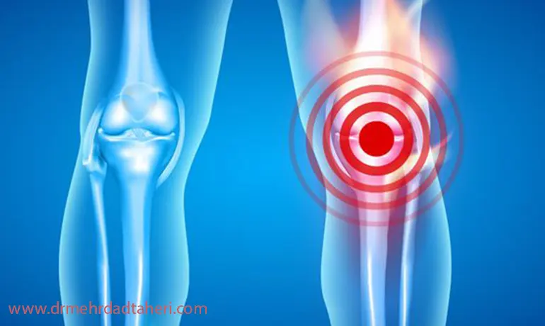 اثربخشی و مدت زمان تسکین رادیوفرکوئنسی