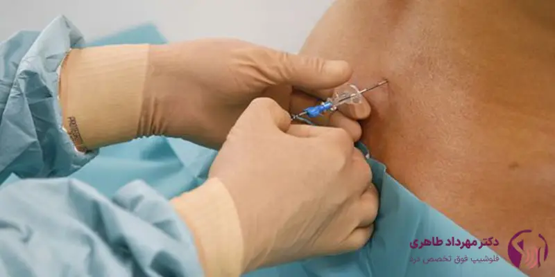 تزریق اپیدورال برای چه افرادی مناسب است؟