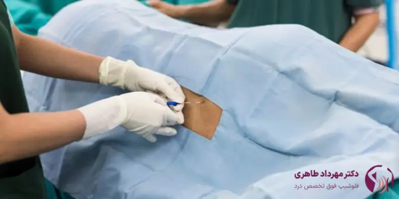 تزریق اپیدورال چیست و چه کاربردی دارد؟