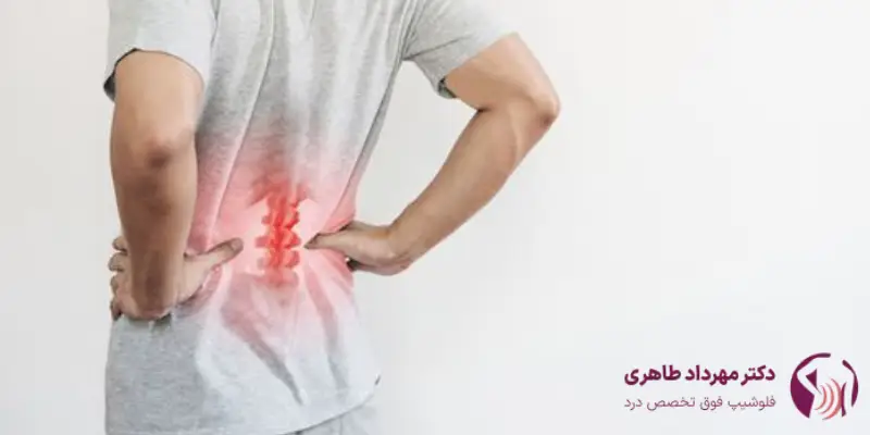 مزیت‌های درمان سیاتیک با تزریق اپیدورال