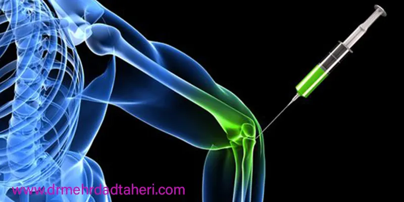 کاربردهای پرولوتراپی