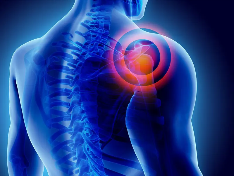 درد حاد در مقابل درد مزمن