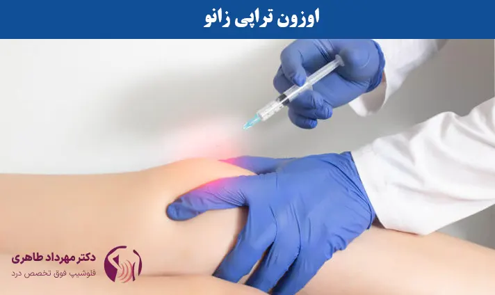 اوزون تراپی زانو