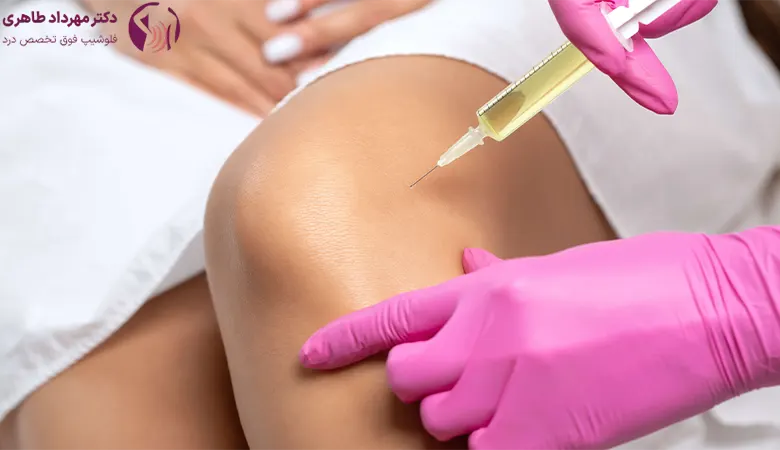 هزینه پی آر پی زانو