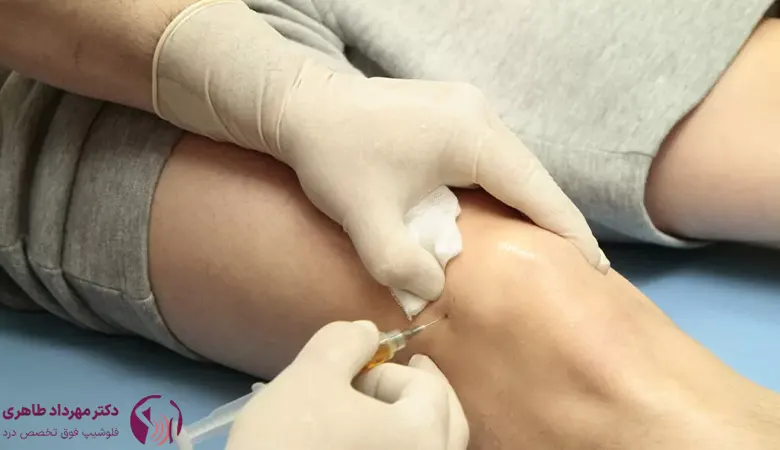 هزینه پی آر پی زانو