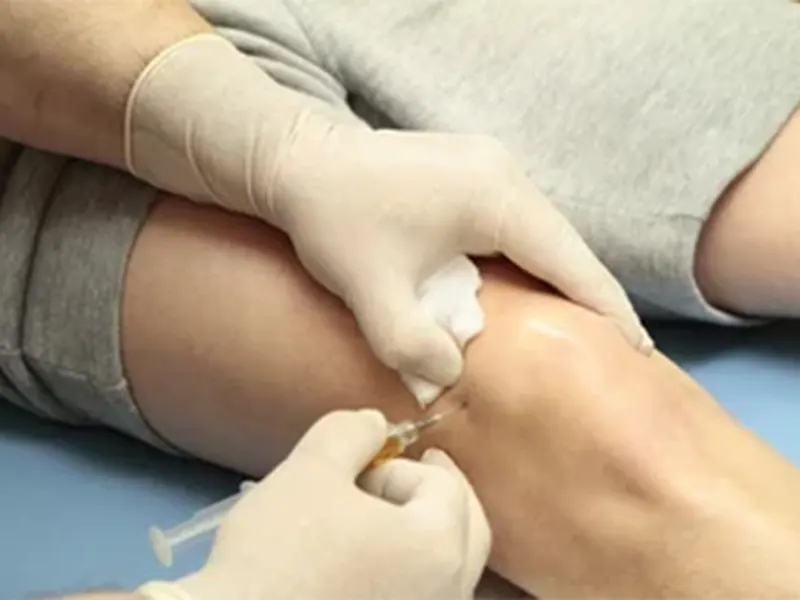 هزینه پی آر پی زانو