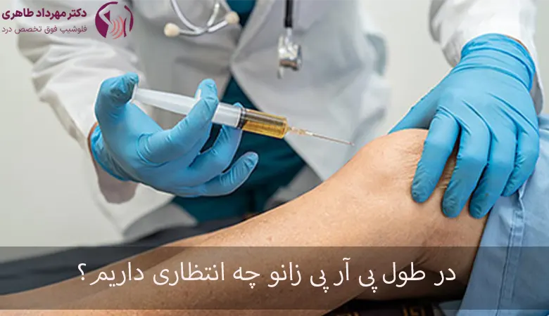 پی آر پی زانو