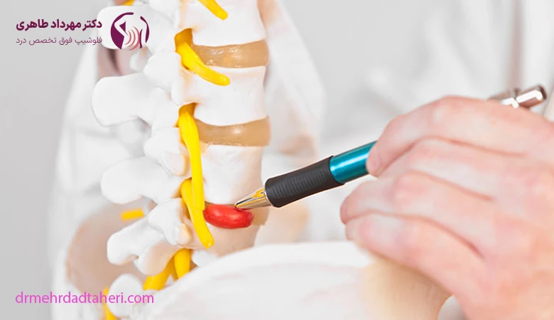 تشخیص پارگی دیسک کمر