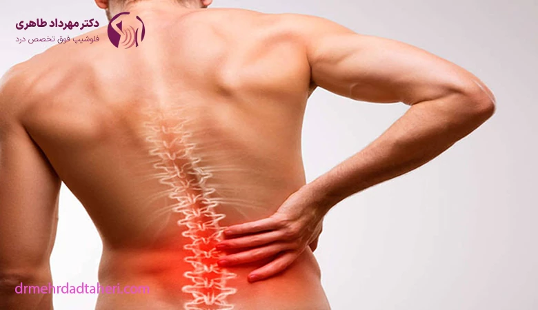 علائم پارگی دیسک کمر
