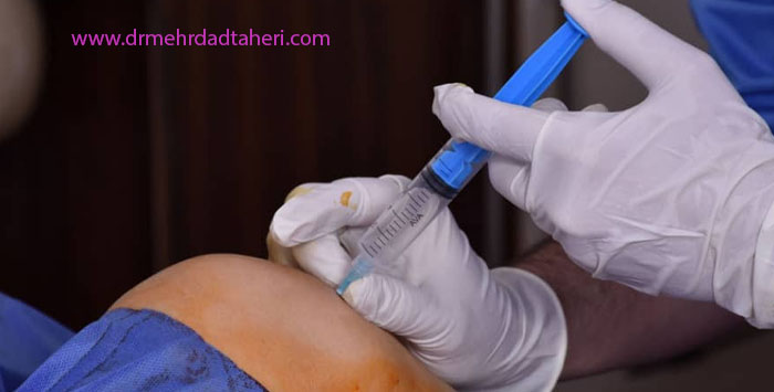 تزریق دیسکوژل چیست؟