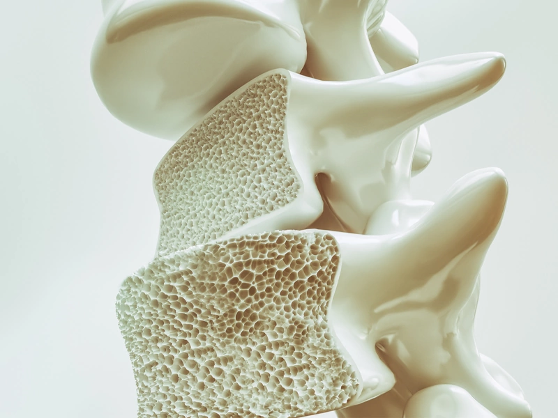 پوکی استخوان را شکست دهید