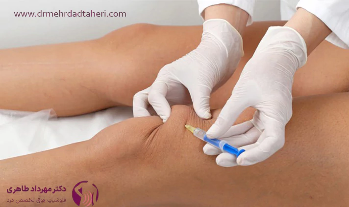 درمان آرتروز زانو با تزریق ژل